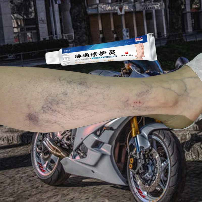 严重曲张蚯蚓腿专用脉通修护灵腿部血管红血丝青筋严重凸起