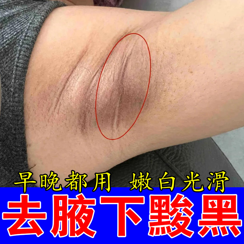 冶胳肢窝褶皱发黑腋下肤色暗沉腋窝粗糙暗沉腋下色素堆积肌肤护膏