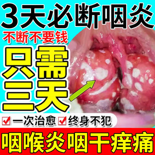 【自营】进口咽炎专用特效药咽喉炎慢性咽炎除根喷剂喉咙贴片咳嗽