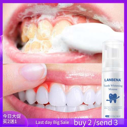 Teeth Whitening Mousse Tooth