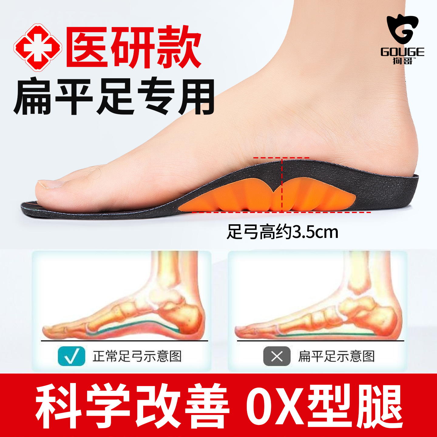 【扁平足矫正鞋垫】科学改善腿型