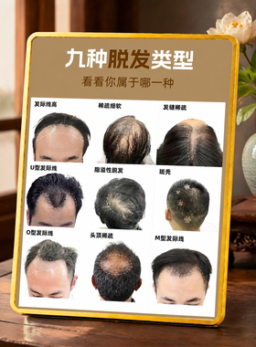 九种脱发类型科普展示摆件养发馆理发店门店桌面装饰摆台