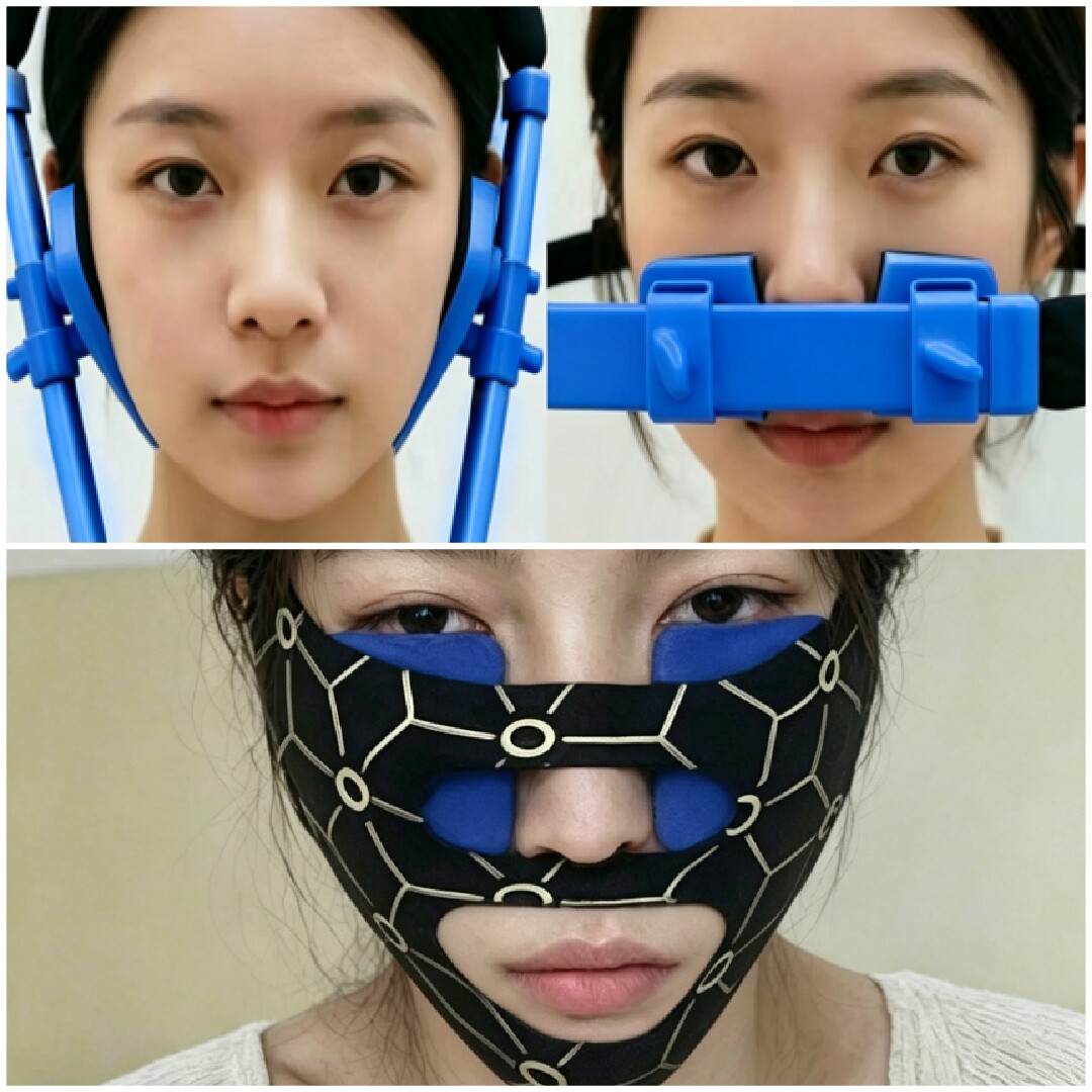 全脸内推瘦脸器矫正太阳穴凹陷额骨下颚骨法令纹眉骨V脸