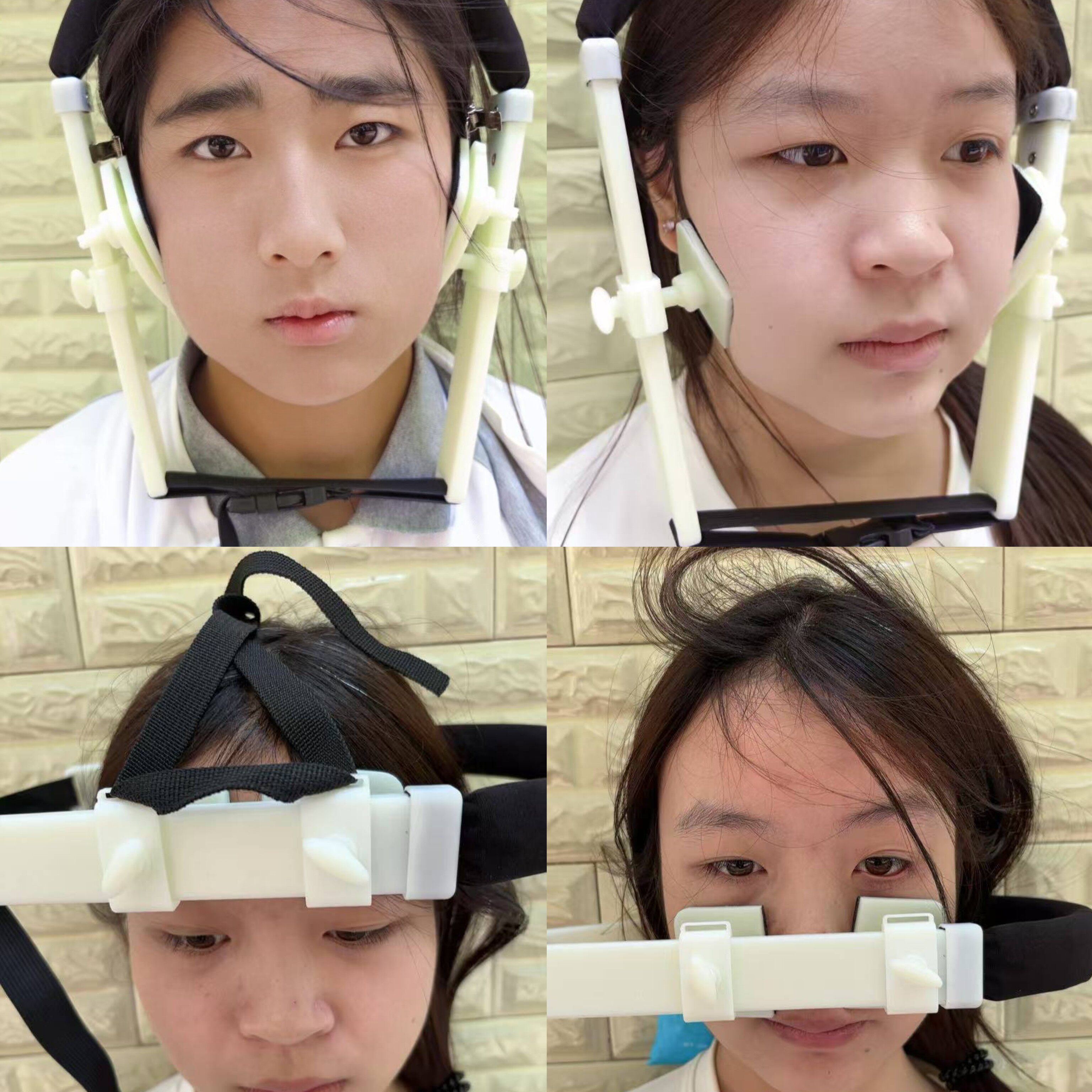 瘦脸神器全脸内推瘦脸矫正v脸太阳穴凹陷大小脸眉骨法令纹V脸