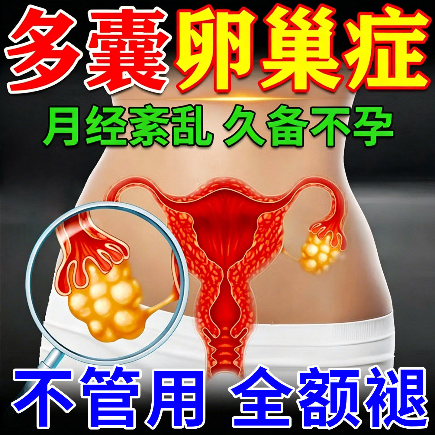 多囊卵巢综合征症调理排卵中药泡脚包不月经促排助备孕内分泌失调