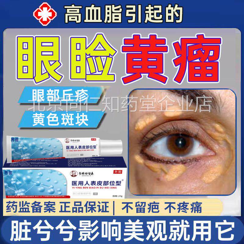 眼睑黄色瘤黄瘤睑黄疣眼角黄斑瘤眼肪部脂粒药监备案膏去除祛MR