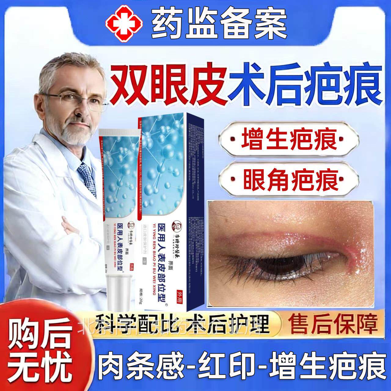 割双眼皮术后祛疤膏消神器疤痕贴开眼角增生凸起手术去疤除疤U肿U