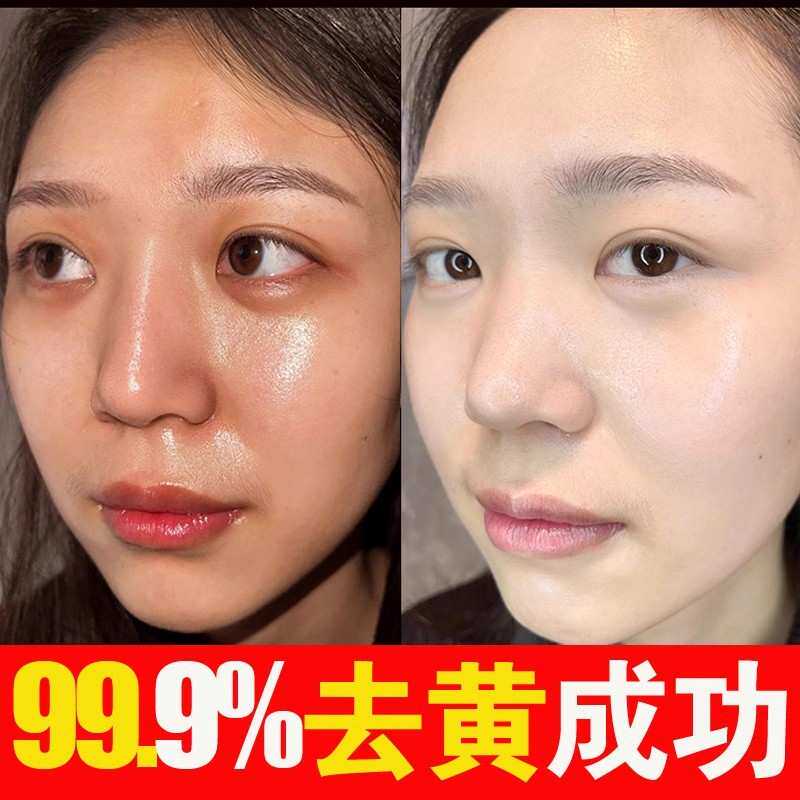 美白祛斑精华液分解黑色素水乳液补水保湿去黄气改善暗沉提亮肤色