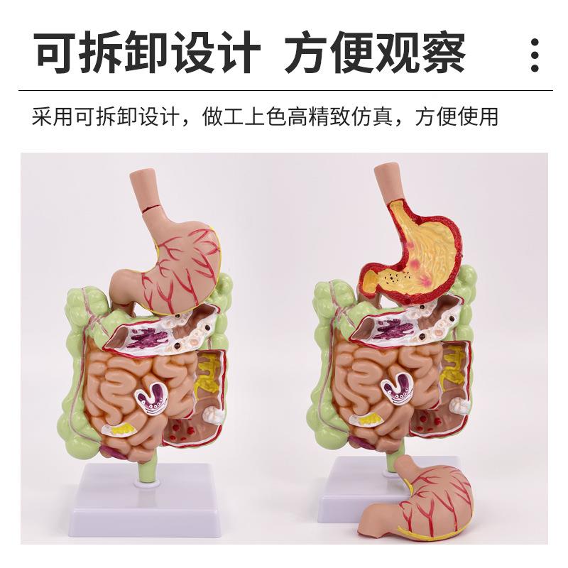 人体盲大肠病理模型肠胃模解剖型病态大肠肠直肠模十二指肠型
