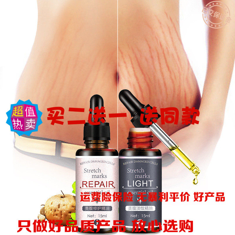 [诚信诚信店家么么哒复方精油]祛妊娠纹套盒 祛腹部纹精油 祛腹部纹月销量0件仅售36.2元