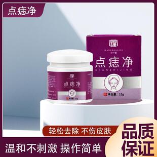 祛痣点痣的药i膏无痕正品脸部祛斑点痣去除肉痣取黑痣痦子专用