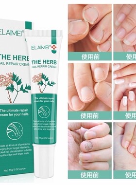 ELAIMEI指甲膏儿童增厚霜护理甲床受损护甲油长甲营养液