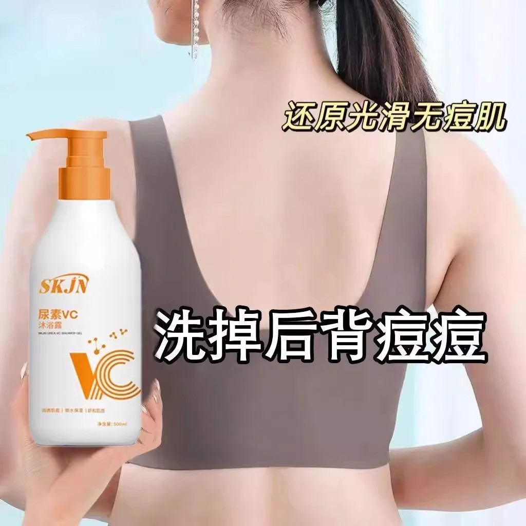 SKJN尿素VC沐浴露去鱼鳞皮鸡皮角质祛背痘光滑嫩白肌肤温和沐浴露