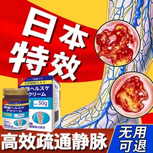 静脉曲张冷敷凝胶专用膏非治疗静脉曲张专用药青筋凸起特效非药