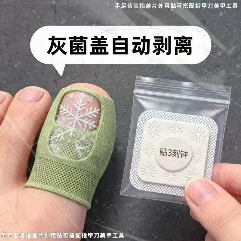 【官方正品】指甲贴正品专用灰趾贴植物萃取脚趾手指甲修护专用贴