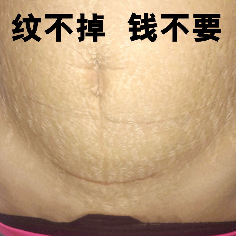 【小红书推荐】身体不留一丝痕迹