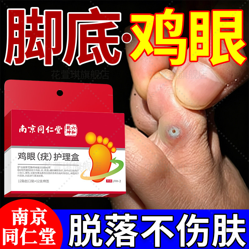 同仁堂鸡眼贴鸡眼膏除手足部去脚底脚趾跖老肉茧疣正品官方旗舰店
