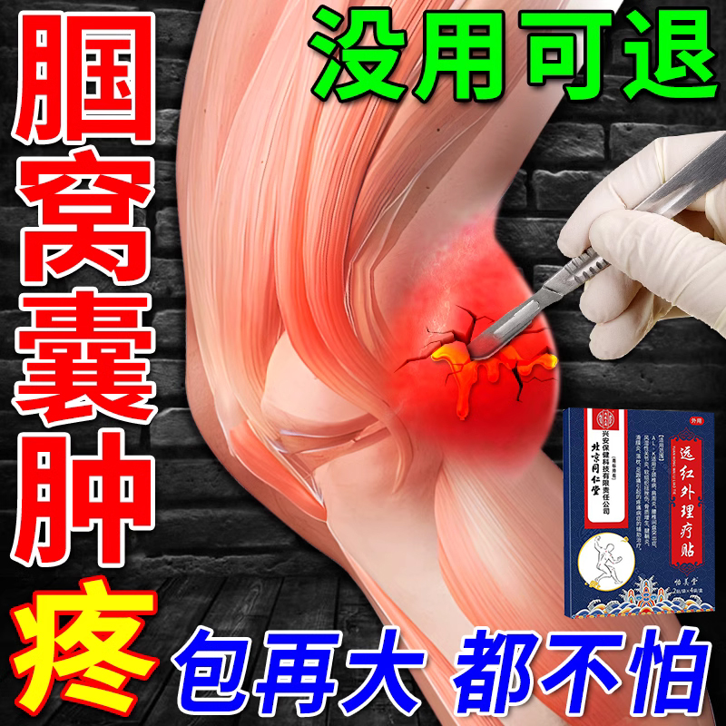 北京同仁堂腘窝囊肿贴鼓包肿胀