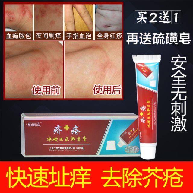 治疗干疮疥疮结节疥虫阴虱螨虫阴囊皮肤瘙痒干疮膏止痒外用的药膏