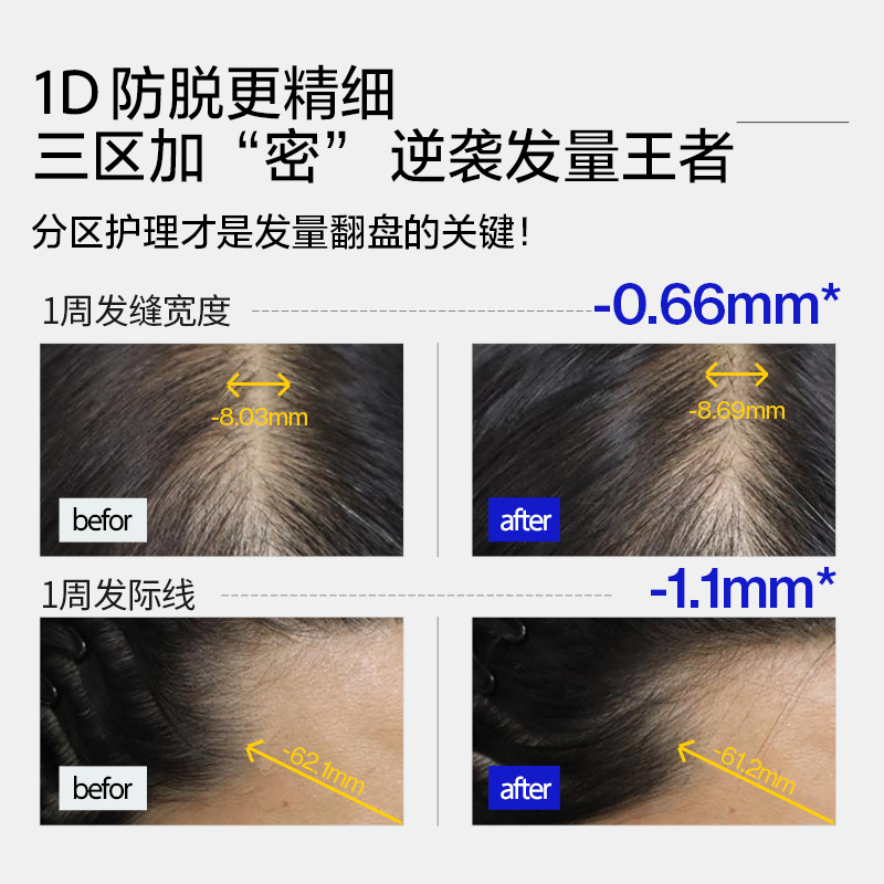 【蜂狂双12·美丽节】 EHD净澈防脱固发精华液滚珠DB