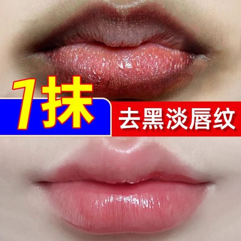 樱桃唇膜贴保湿滋润嘴唇周边暗沉发黑去黑色素去死皮淡化唇纹贴片,美容护肤/美体/精油,唇膜,淘宝优惠券,粉丝福利购,淘宝优惠卷