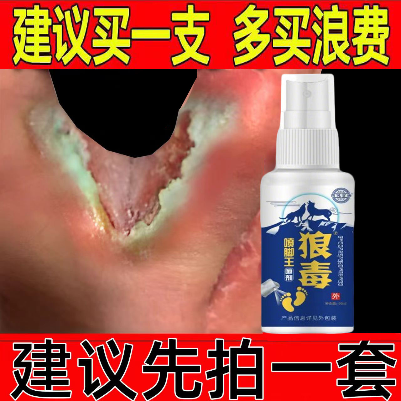 狼毒脚喷脚气膏红痒膏真菌感染水脱皮泡烂脚丫小水泡痒烂杀喷雾剂