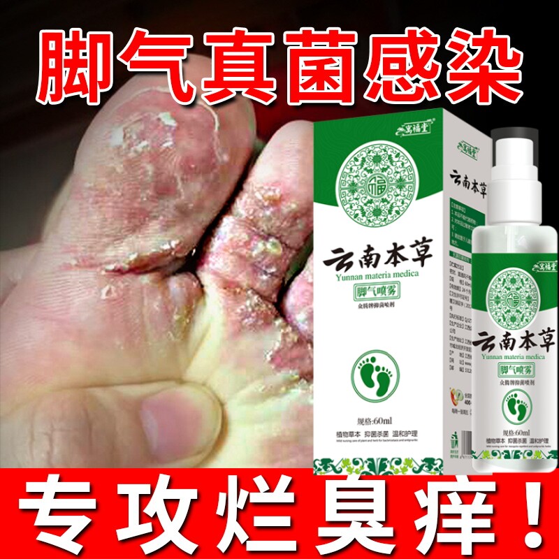 云南草本脚气喷剂脚抑菌液喷剂百草止痒脱皮异味烂脚丫脚臭膏脚痒