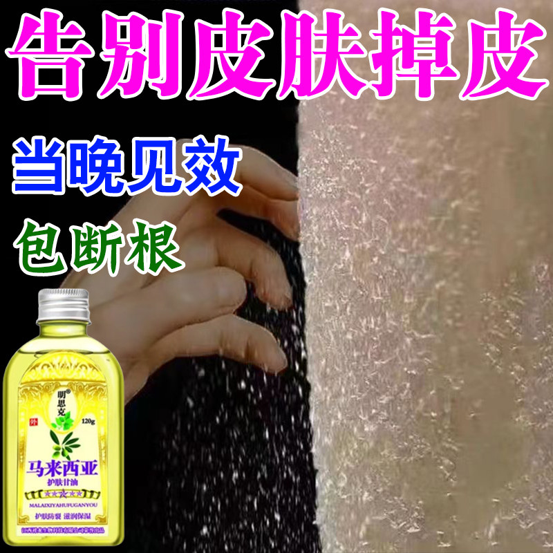 皮肤干燥起皮身体油马来西亚护肤甘油鱼鳞皮润肤乳液全身干燥皮肤