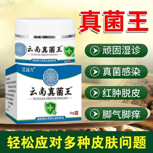 艾益方云南真菌王百草真菌王快速皮肤外用膏皮肤膏体祛痱去祛痒王