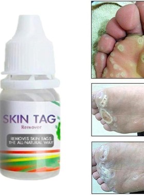 2pcs Plantar Genital Warts Ointment Skin Tag Remover Cream