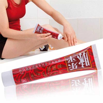 Varicose Veins Cream Treatment Ointment Removal Vasculitis