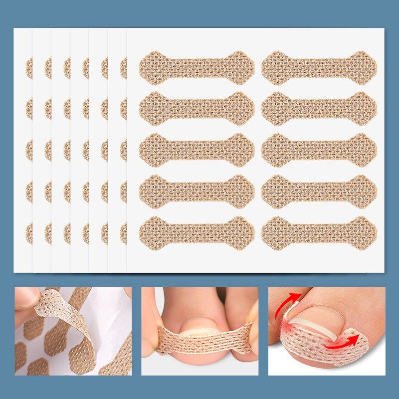 Nail Straightening Patch Ingrown Nail Corrector Toe Cushion
