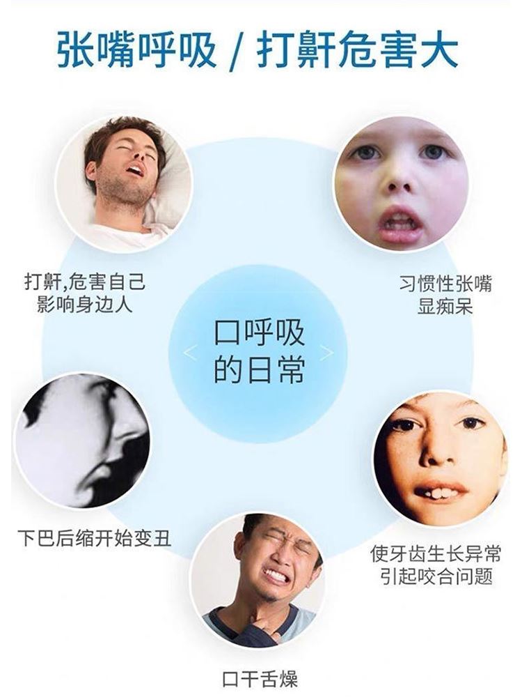 腺样体肥大面容矫正器儿童口呼吸矫正器睡觉防张嘴打呼噜下巴带