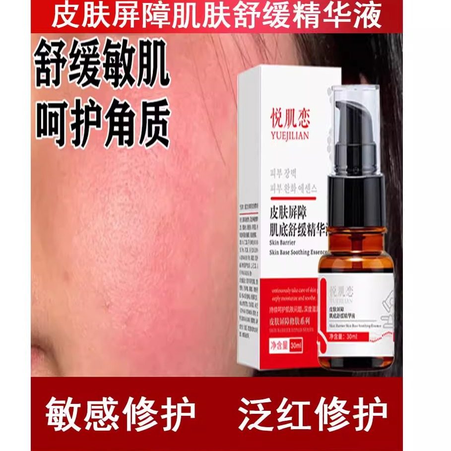 敏感肌修护精华液改善红血丝增强角质层脸部泛红舒缓修复护肤品套