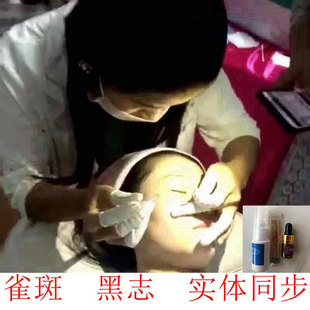 无痛点斑水 雀斑黑点专用痦子提取原液无痕净擦淡化供美容院