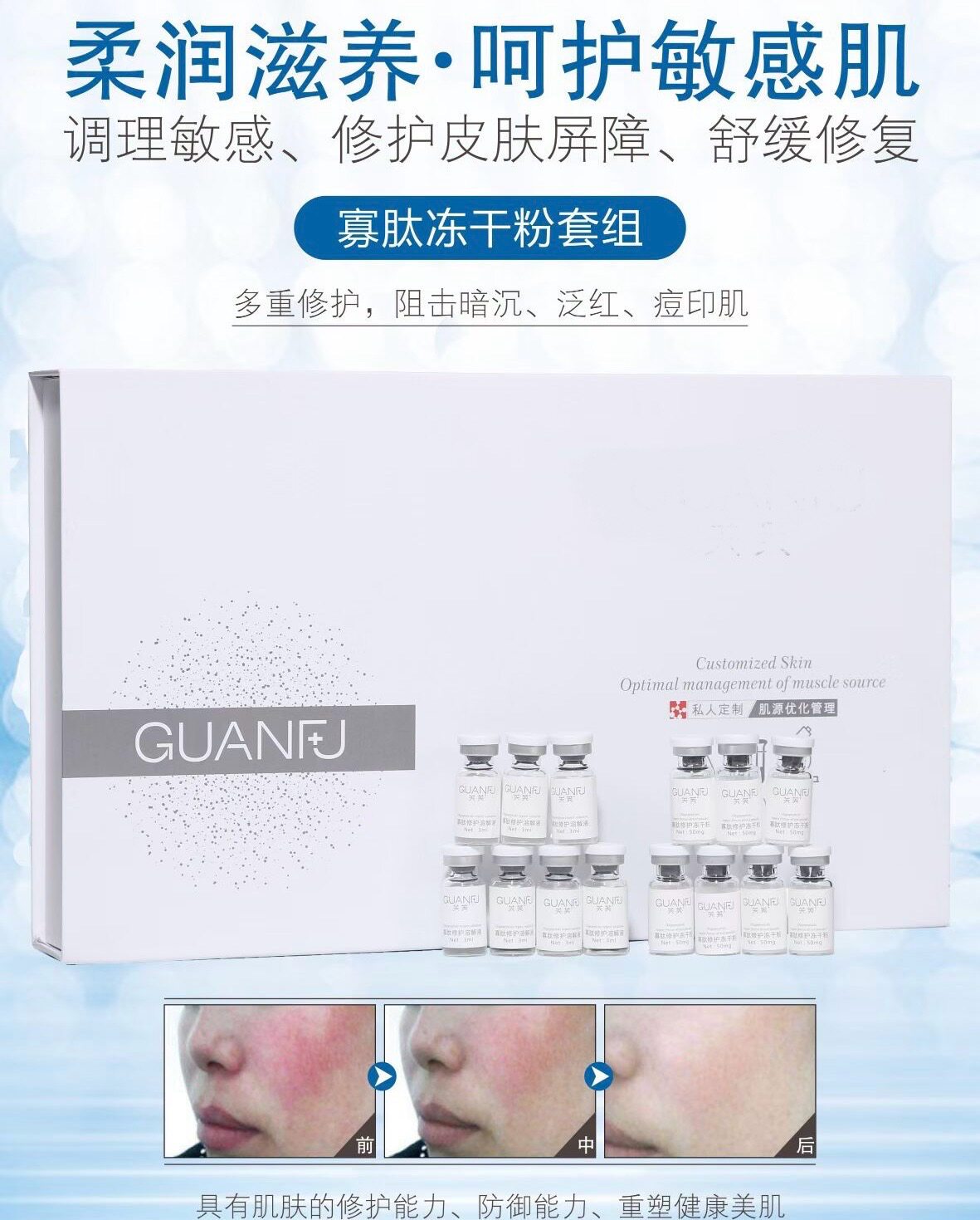 寡肽修护冻干粉套盒10对/盒美容项目后修复肌肤敏感泛红痘肌干燥