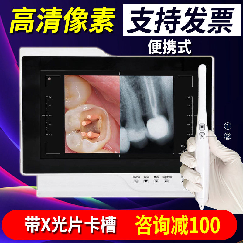 牙科口腔内窥镜一体机观察仪