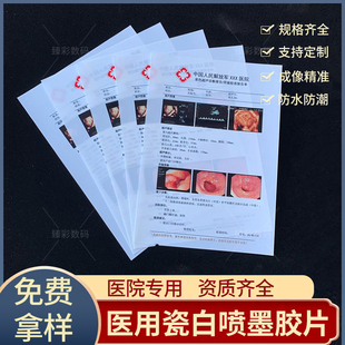 医用超声胶片彩超胶片胃镜胶片四维胶片B超胶片白色喷墨胶片包邮