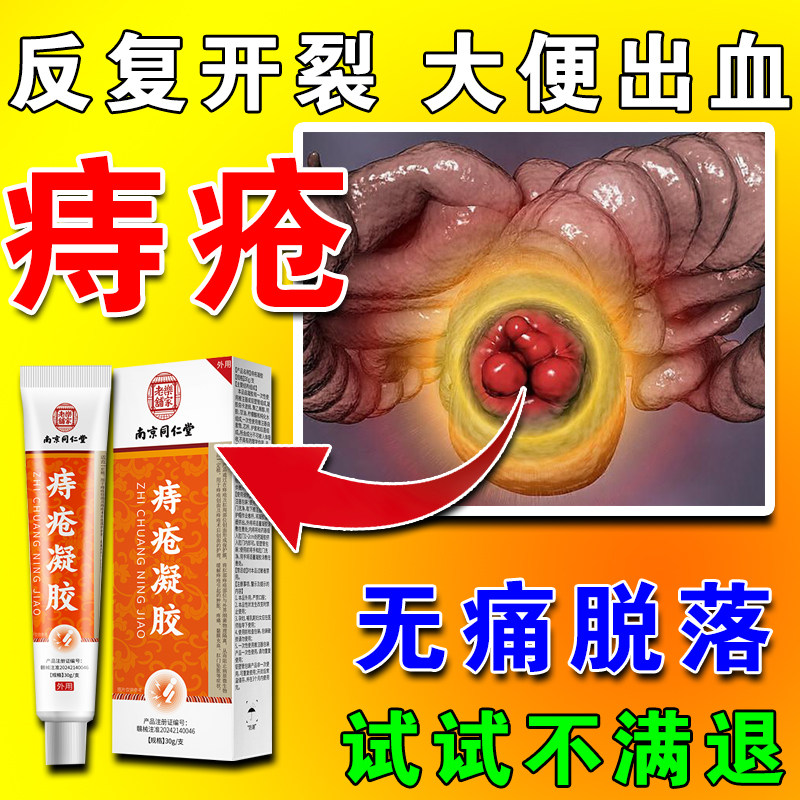 南京同仁堂痔疮凝胶痔疮膏消肉去除器球正品内外排行榜官方旗舰店