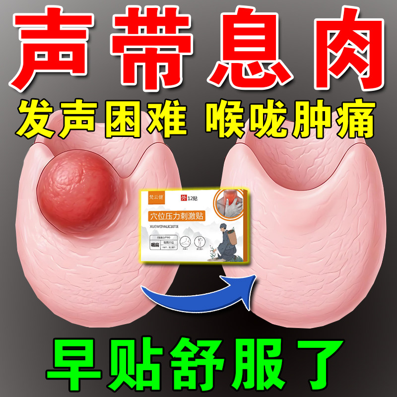 声带息肉药贴喉咙肿痛异物感