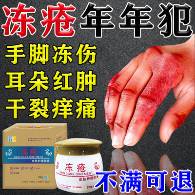 成人儿童通用草本冻疮膏