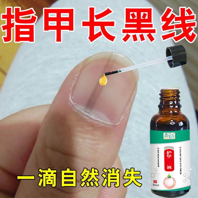 指甲长黑线甲母痣黑指甲专用修复液手脚指甲长黑色竖纹灰甲受损W