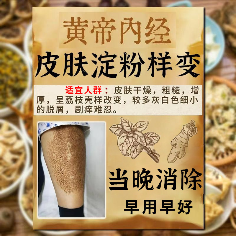 皮肤淀粉样变专用膏冶顽固皮藓改善胳膊腿上皮肤粗糙小颗粒止痒膏