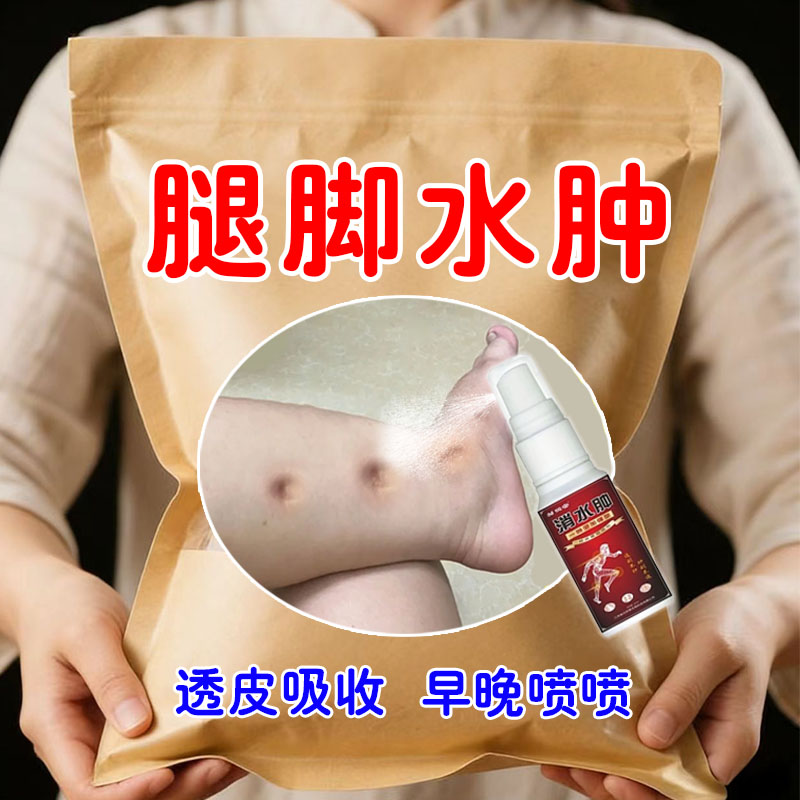 去水肿专用老人腿脚水肿消肿喷剂