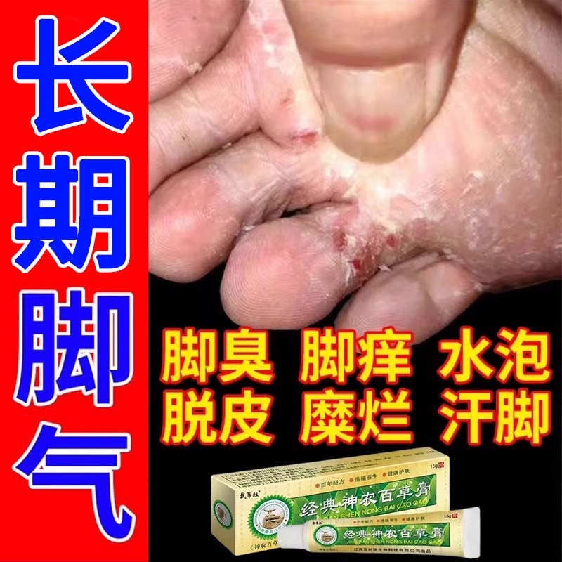 烂脚丫药脱皮糜烂脚趾缝烂痒治脚气去真菌感染脚痒水泡根神器去膏 医疗器械 保健理疗 原图主图