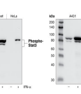 Phospho-Stat3 (Tyr705) (D3A7) XP® Rabbit mAb #9145 一抗