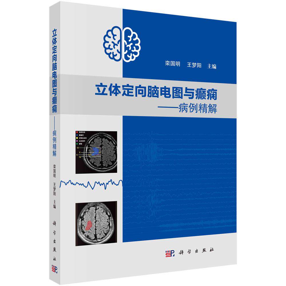 立体定向脑电图与癫痫:病例精解