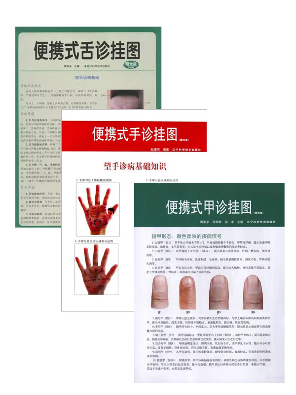 【全3册】便携式手诊挂图（赠光盘）+便携式甲诊挂图（赠光盘）+便携式舌诊挂图（赠光盘） 辽宁科学技术出版社