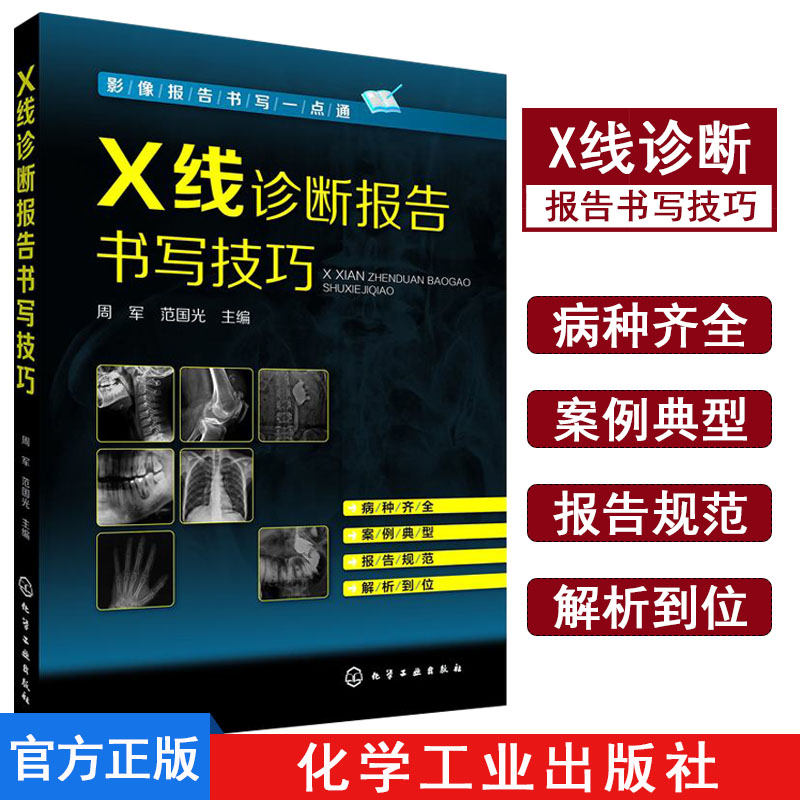 X线诊断入门与提高报告书写技巧周军范国光主编化工出版社精品书