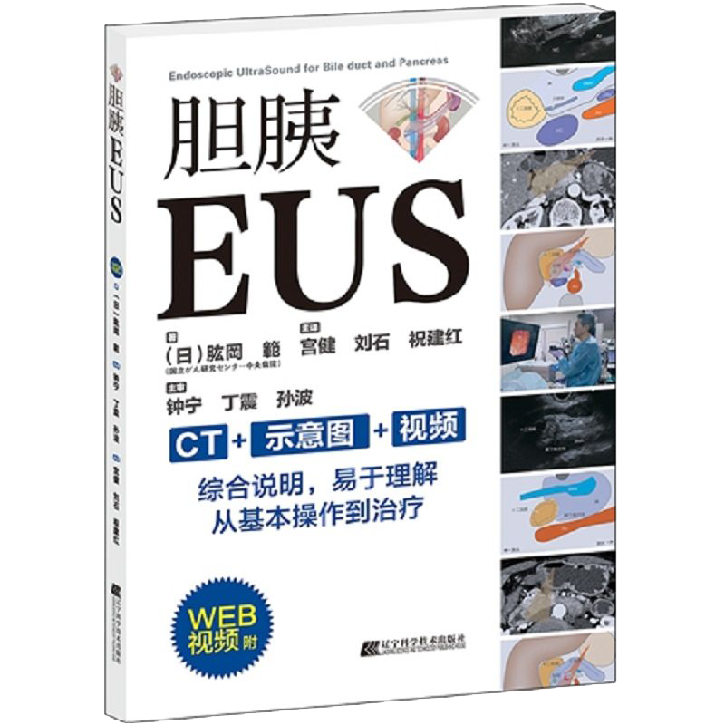 胆胰EUS 内科学 CT示意图视频从基本操作到治疗 判断乳头部肿瘤的浸润进展程度 血管浸润的评估 (日)肱岡 範 辽宁科学技术出版